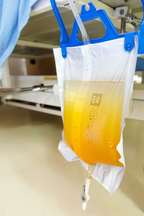 Caring for Indwelling Urethral and Suprapubic Catheters: A Guide for Patients and Caregivers